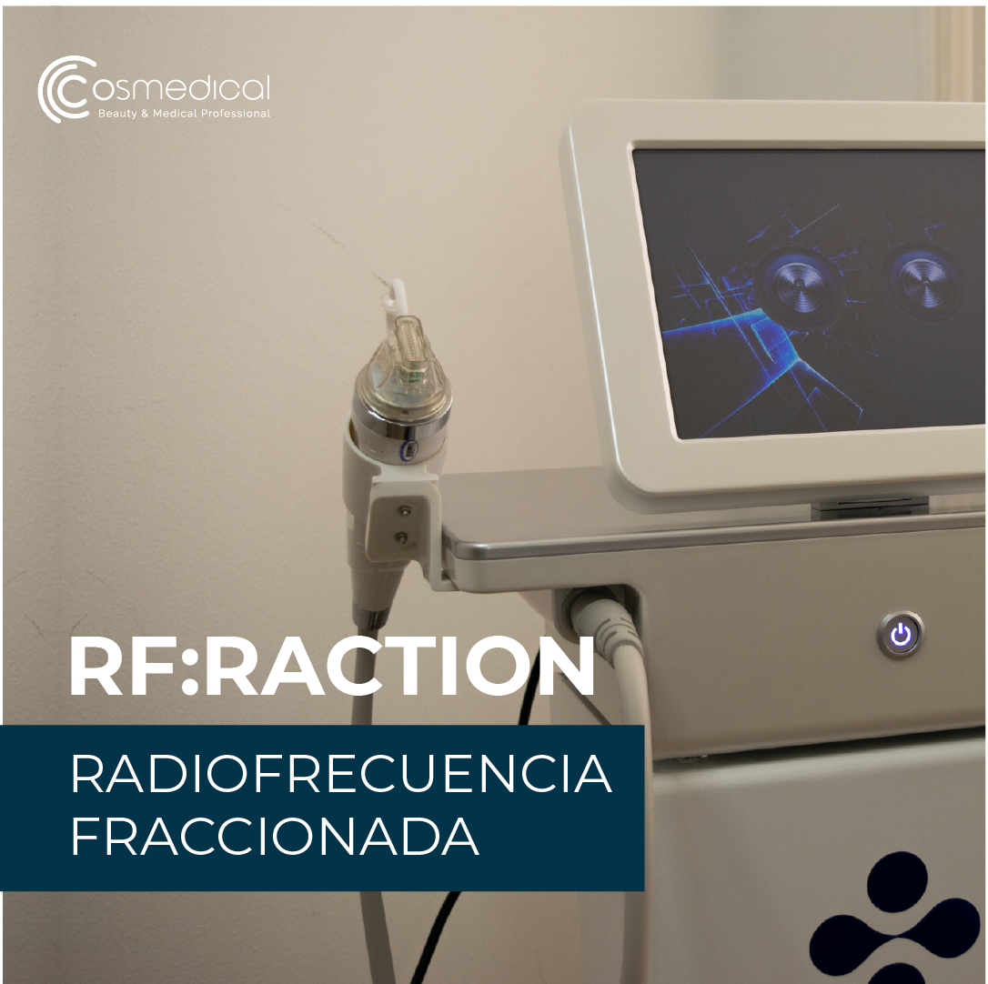 Efectos visibles de la radiofrecuencia fraccionada en la piel