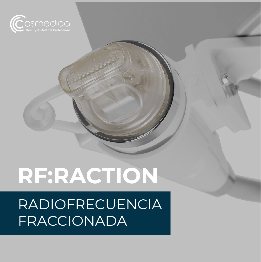 Efectos visibles de la radiofrecuencia fraccionada en la piel